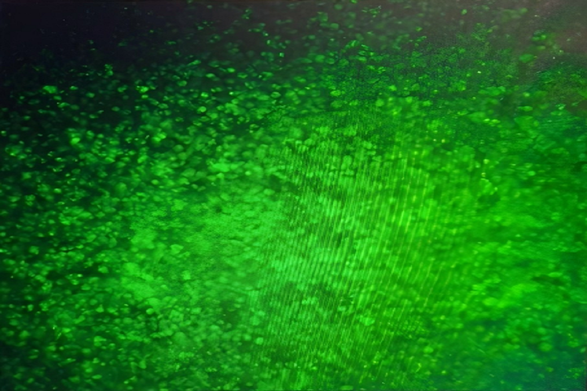 Cell Transfection | Transfection of Jurkat(Human T-Lymphocyte Leukemia Cells)-DNA