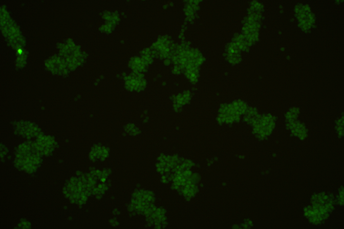 Cell Transfection | Jurkat Human T-Lymphoblastic Leukemia Cells Transfection – DNA