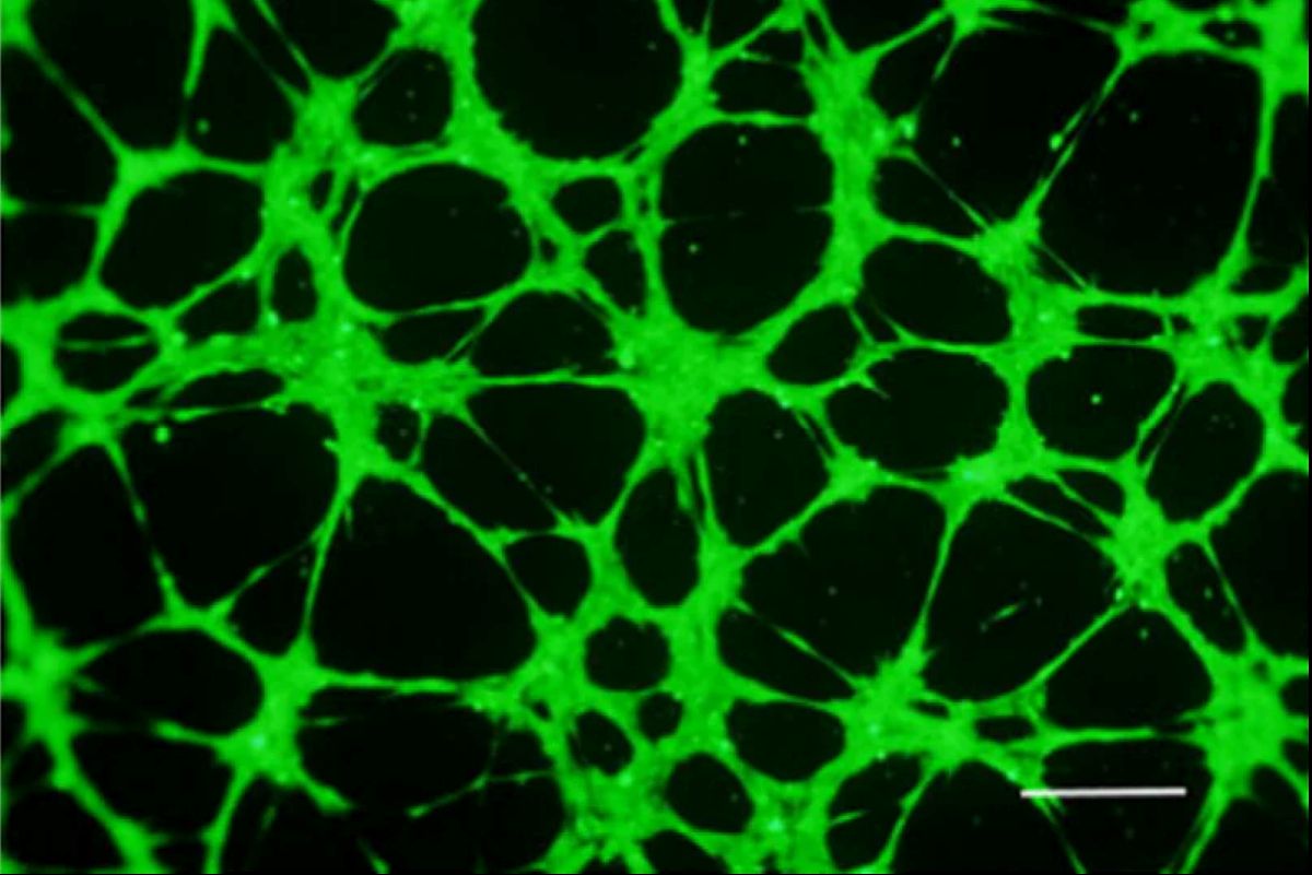 Reference Protocol for Tube Formation Angiogenesis Assay