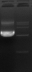 Large-Scale Plasmid Preparation Case Study: High-Yield Plvx-PGK Plasmid from 80 mL Bacterial Culture