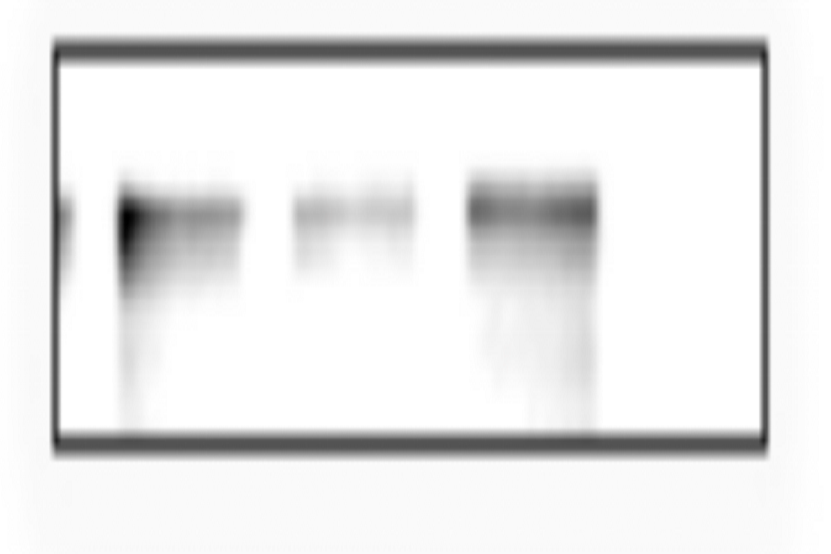 Cell Transfection | HCT-116 Human Colorectal Carcinoma Cells Transfection – siRNA