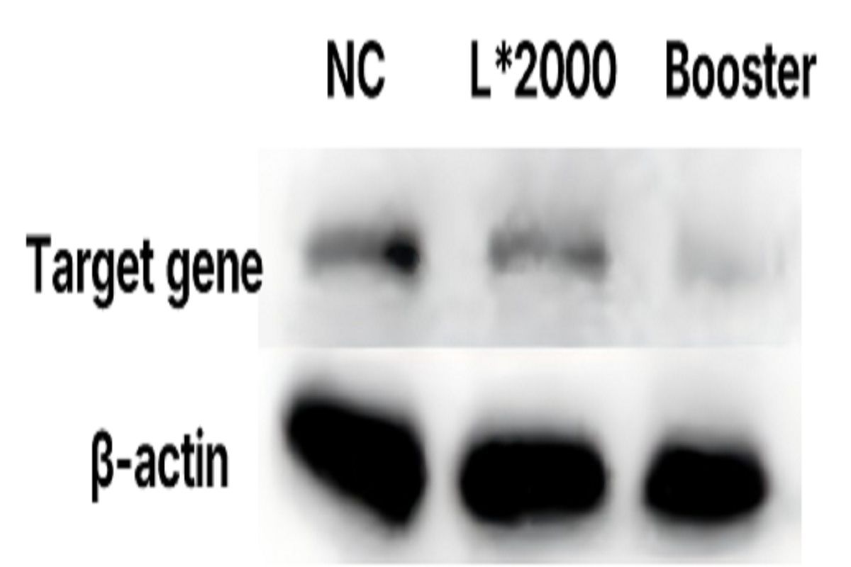 Cell Transfection | Transfection of Primary Glioblastoma Cells(GBMs) – siRNA