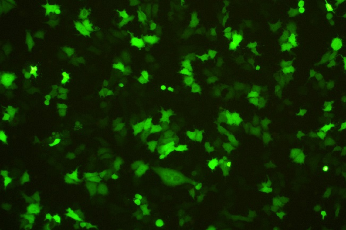 Cell Transfection | HeLa Human Cervical Cancer Cells Transfection – DNA