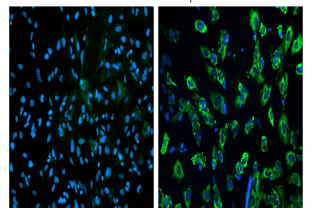 Cell Transfection | Transfection of Primary Mouse Neural Stem Cells(mNSCs)– mRNA