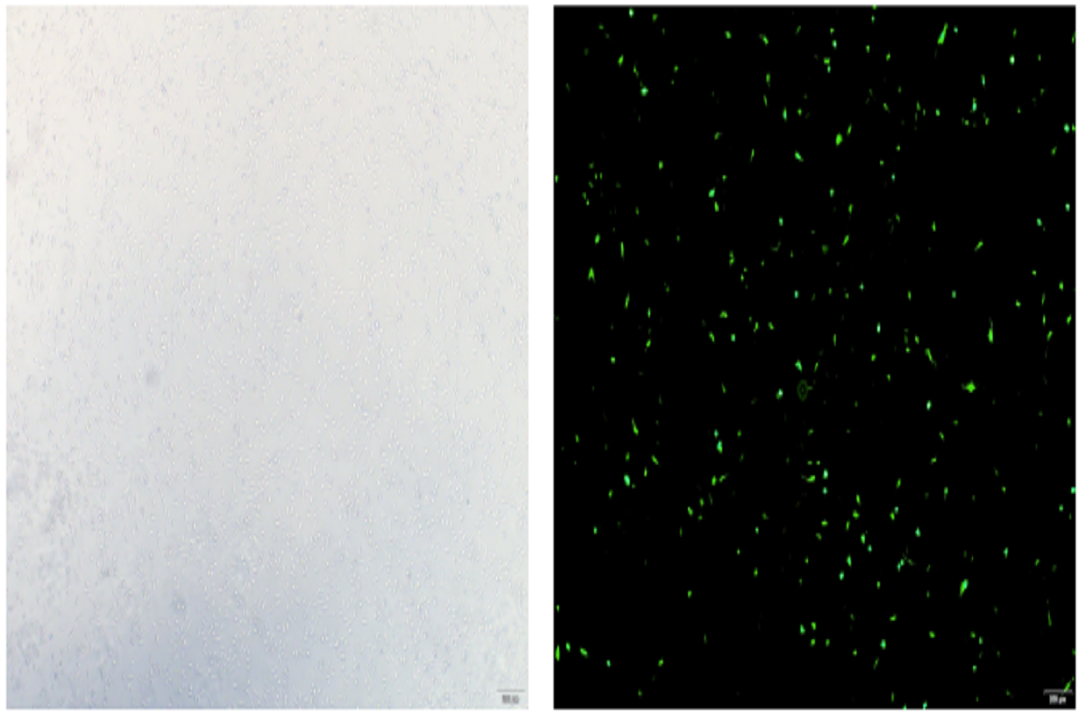 Cell Transfection | Transfection of Primary Porcine Skeletal Muscle Satellite Cells (PSCs/PMSCs) – DNA