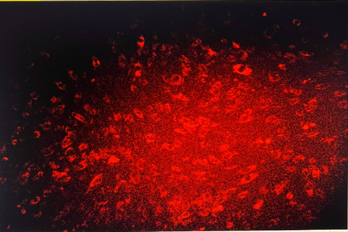 Cell Transfection | Transfection of Primary Human Dermal Fibroblasts