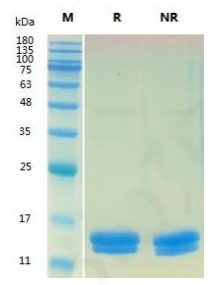 Human IL-2 Protein (CHO) _ 90267es