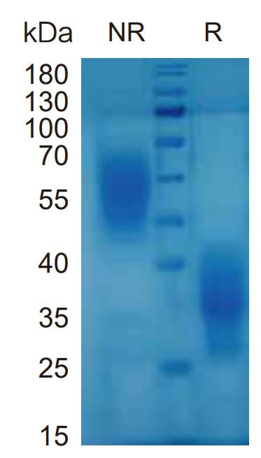 माउस IL-5 प्रोटीन (HEK293) _ 90242ES