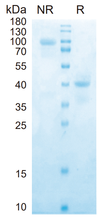โปรตีน IL-12 ของมนุษย์ (HEK293) _ 90234ES