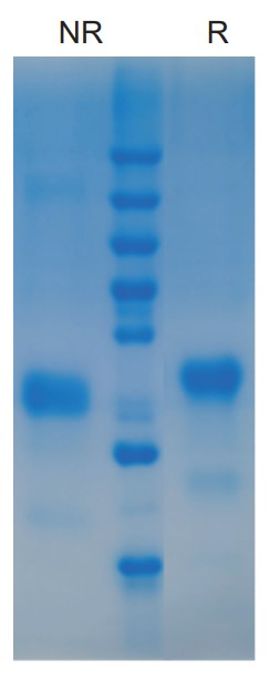 Human IL-34 Protein _ 90206ES