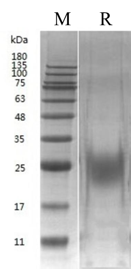 Human IL-7 Protein (CHO) _ 90261ES